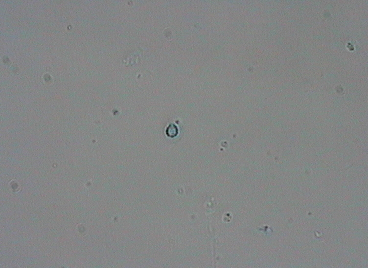 Dictyocha speculum